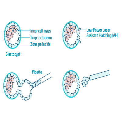 PGT Medical Illustration